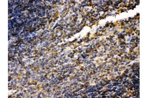 Immunohistochemistry (IHC) image for anti-Transglutaminase 2 (C Polypeptide, Protein-Glutamine-gamma-Glutamyltransferase) (TGM2) (AA 7-34), (N-Term) antibody (ABIN3043946)