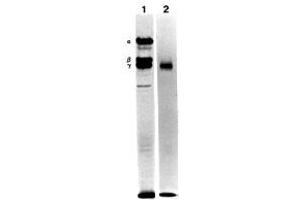 Immunoprecipitation of the culture medium of human pancreatic carcinoma cells (metabolically labeled with S35Ðmethionine) with MAb BC17 (Laminin g1) (Lane 1). (Laminin gamma 1 Antikörper)