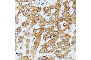 Immunohistochemistry (IHC) image for anti-Mitogen-Activated Protein Kinase Kinase Kinase 1 (MAP3K1) (C-Term) antibody (ABIN7268647)