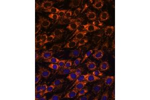 Immunofluorescence analysis of C6 cells using  antibody (ABIN7265368) at dilution of 1:100. (ACAA2 Antikörper  (AA 1-250))