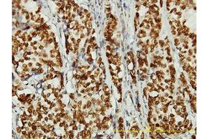 Image no. 1 for anti-Non-SMC Condensin II Complex, Subunit D3 (NCAPD3) (AA 1-341) antibody (ABIN466186) (NCAPD3 Antikörper  (AA 1-341))