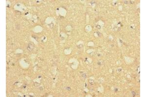 Immunohistochemistry of paraffin-embedded human brain tissue using ABIN7158190 at dilution of 1:100 (LRRC4C Antikörper  (AA 201-500))