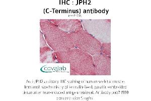 Image no. 2 for anti-Junctophilin 2 (JPH2) (C-Term) antibody (ABIN1736131) (Junctophilin 2 Antikörper  (C-Term))