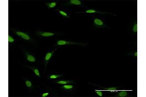 Immunofluorescence of purified MaxPab antibody to ZNF71 on HeLa cell. (ZNF71 Antikörper  (AA 1-489))