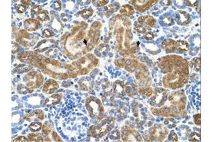 ATIC antibody was used for immunohistochemistry at a concentration of 4-8 ug/ml. (ATIC Antikörper  (Middle Region))