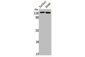 Western Blot analysis of Jurkat A549 cells using GCP5 Polyclonal Antibody (TUBGCP5 Antikörper  (Internal Region))