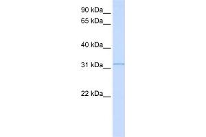 WB Suggested Anti-SUSD4 Antibody Titration:  0. (SUSD4 Antikörper  (N-Term))