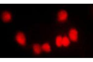 Immunofluorescent analysis of HKR1 staining in NIH3T3 cells. (HKR1 Antikörper  (Center))
