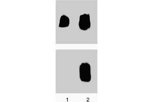 Jurkat cells were either untreated (lane 1) or treated (lane 2) with Anti-CD3 for 15 minutes at 37°C. (LCK Antikörper  (pTyr505))