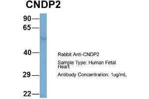 Host: Rabbit  Target Name: CNDP2  Sample Tissue: Human Fetal Heart  Antibody Dilution: 1.