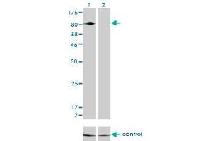 Western blot analysis of ITGB5 over-expressed 293 cell line, cotransfected with ITGB5 Validated Chimera RNAi (Lane 2) or non-transfected control (Lane 1). (Integrin beta 5 Antikörper  (AA 421-516))