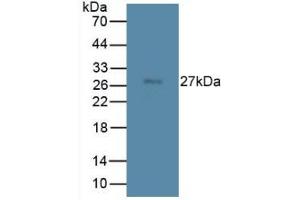Western blot analysis of Rat Spleen Tissue. (TMEM27 Antikörper  (Leu222))