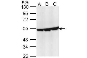 WB Image Sample (30 ug of whole cell lysate) A: Hep G2 , B: Molt-4 , C: Raji 10% SDS PAGE antibody diluted at 1:1000 (ENO3 Antikörper)