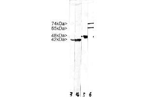 Strip blots of crude HeLa cell extract stained with MCS-4C4. (Lamin A/C Antikörper)