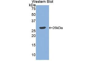 Western blot analysis of the recombinant protein. (Angiopoietin 1 Antikörper  (AA 266-497))