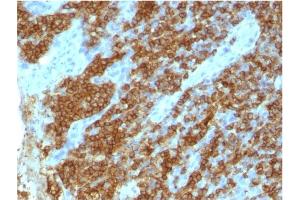 Formalin-fixed, paraffin-embedded human tonsil stained with CD45RA Mouse Monoclonal Antibody (111-1C5) (CD45 Antikörper)