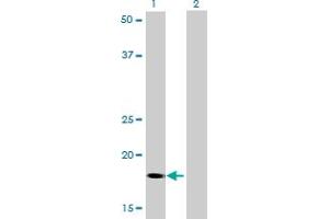 Western Blot analysis of RNF181 expression in transfected 293T cell line by RNF181 monoclonal antibody (M01), clone 5A7.
