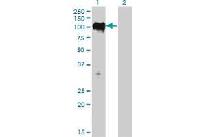Western Blot analysis of TTK expression in transfected 293T cell line by TTK monoclonal antibody (M01), clone 3G7. (Mps1 Antikörper  (AA 1-176))