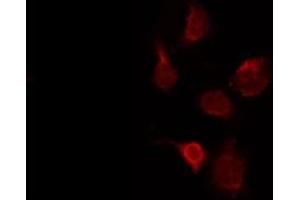 ABIN6273991 staining Hela by IF/ICC. (TUBA4A Antikörper  (N-Term))