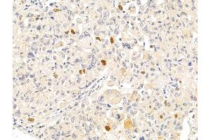 Anillin Antibody at 1/100 staining Rat stomach tissue by IHC-P. (Anillin Antikörper  (C-Term))