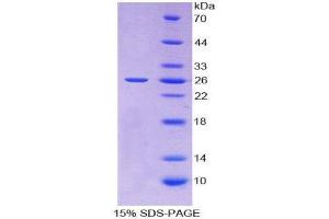 SDS-PAGE (SDS) image for TIMP Metallopeptidase Inhibitor 3 (TIMP3) (AA 26-211) protein (His tag) (ABIN2126972)