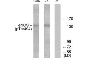 Western Blotting (WB) image for anti-Nitric Oxide Synthase 3 (Endothelial Cell) (NOS3) (pThr494) antibody (ABIN1847469) (ENOS Antikörper  (pThr494))