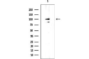 anti-DEAD (Asp-Glu-Ala-Asp) Box Polypeptide 10 (DDX10) (N-Term) antibody