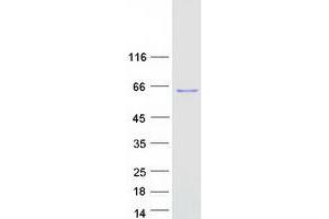 Western Blotting (WB) image for HSPB (Heat Shock 27kDa) Associated Protein 1 (HSPBAP1) protein (Myc-DYKDDDDK Tag) (ABIN2723118)