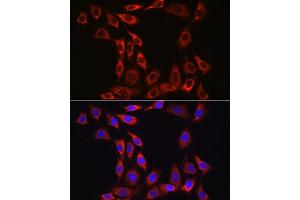 Immunofluorescence analysis of NIH/3T3 cells using IL15RA Rabbit pAb (ABIN3017117, ABIN1680439 and ABIN7101500) at dilution of 1:100 (40x lens). (IL15RA Antikörper  (AA 31-205))