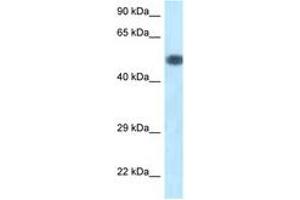 Image no. 1 for anti-Phosphoinositide 3 Kinase, p85 alpha (PI3K p85a) (AA 180-229) antibody (ABIN6747416) (PIK3R1 Antikörper  (AA 180-229))