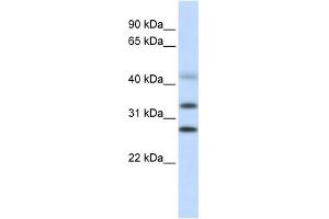 CENPH antibody used at 1 ug/ml to detect target protein. (CENPH Antikörper  (Middle Region))