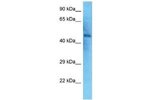 Host:  Rabbit  Target Name:  NEK2  Sample Type:  Thyroid Tumor lysates  Antibody Dilution:  1. (NEK2 Antikörper  (N-Term))