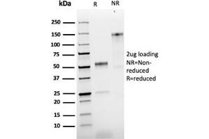 SDS-PAGE Analysis Purified NGFR Rabbit Recombinant Monoclonal Antibody (NGFR/1997R). (Rekombinanter NGFR Antikörper)