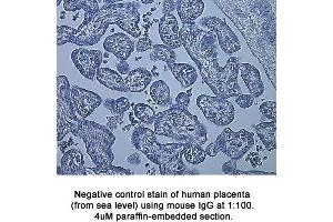 Image no. 1 for anti-Hypoxia Inducible Factor 1, alpha Subunit (Basic Helix-Loop-Helix Transcription Factor) (HIF1A) (AA 329-530) antibody (ABIN363210) (HIF1A Antikörper  (AA 329-530))