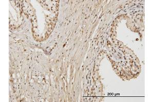 Immunoperoxidase of monoclonal antibody to RAB17 on formalin-fixed paraffin-embedded human prostate. (RAB17 Antikörper  (AA 1-212))
