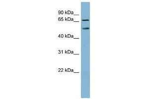 MYST1 antibody used at 1 ug/ml to detect target protein. (MYST1 Antikörper  (N-Term))