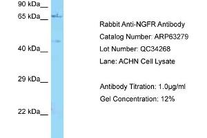 Western Blotting (WB) image for anti-Nerve Growth Factor Receptor (NGFR) (C-Term) antibody (ABIN2789433) (NGFR Antikörper  (C-Term))