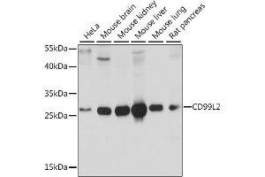 Western blot analysis of extracts of various cell lines, using CD99L2 antibody (ABIN7266229) at 1:1000 dilution. (CD99L2 Antikörper  (AA 26-185))