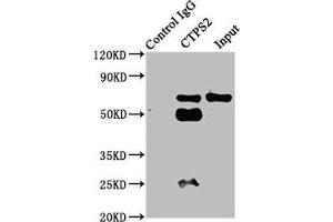 Immunoprecipitating CTPS2 in HepG2 whole cell lysate Lane 1: Rabbit control IgG instead of ABIN7148718 in HepG2 whole cell lysate. (CTPS2 Antikörper  (AA 62-315))