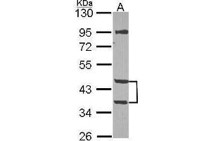 WB Image Sample (30 ug of whole cell lysate) A: NT2D1 10% SDS PAGE antibody diluted at 1:1000 (MPI Antikörper)