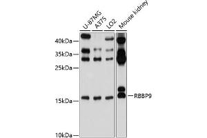Western blot analysis of extracts of various cell lines, using RBBP9 antibody (ABIN6129095, ABIN6146752, ABIN6146753 and ABIN6220638) at 1:1000 dilution. (RBBP9 Antikörper  (AA 1-186))