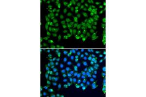 Immunofluorescence analysis of MCF-7 cells using RNF8 antibody. (RNF8 Antikörper)