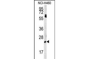 Western blot analysis in NCI-H460 cell line lysates (15ug/lane). (EBPL Antikörper  (C-Term))