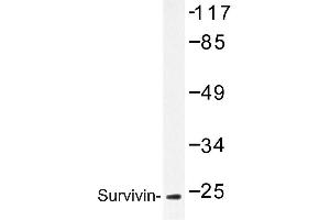 Image no. 1 for anti-Baculoviral IAP Repeat-Containing 5 (BIRC5) antibody (ABIN272115) (Survivin Antikörper)