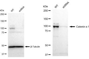 Western blotting analysis using Catenin alpha 1 antibody (ABIN7797923).