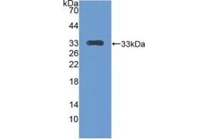 Detection of Recombinant CENPH, Mouse using Polyclonal Antibody to Centromere Protein H (CENPH) (CENPH Antikörper  (AA 28-241))