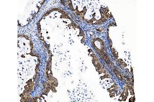 IHC analysis of PRDM14 using anti-PRDM14 antibody (ABIN7603152). (PRDM14 Antikörper  (N-Term))
