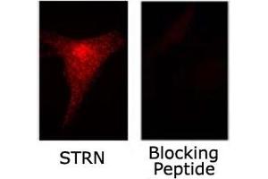 Immunofluorescence staining of STRN on NIH/3T3 cells with or without blocking peptide with STRN polyclonal antibody . (Striatin Antikörper)