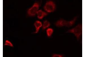 ABIN6274952 staining HuvEc by IF/ICC. (CHST10 Antikörper  (Internal Region))