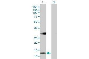Lane 1: RBP5 transfected lysate ( 14.